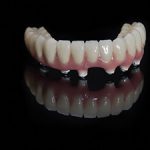 fixed denture