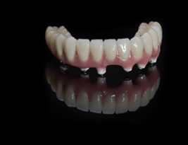 The implant denture