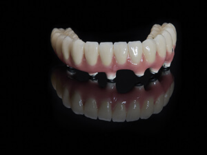 fixed denture